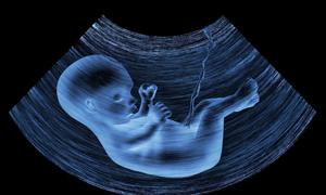 孕中期性生活的安全指引