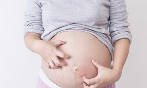 孕晚期肚疼要注意什么